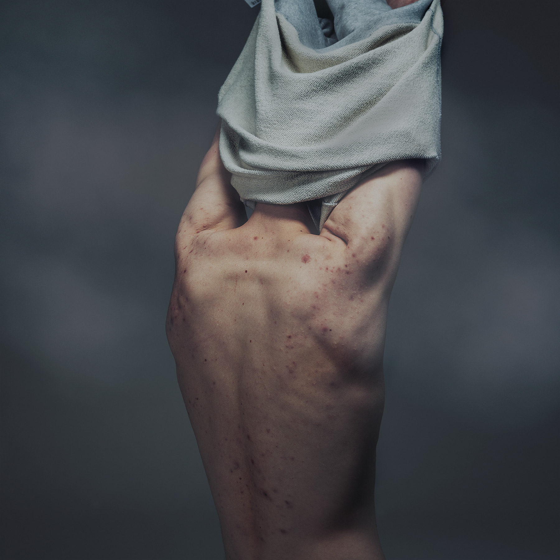 Galderma_GoodboyWolf_SHOT_06_0018